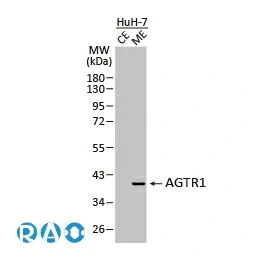 AGTR1 antibody [HL2524]